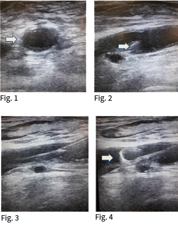 Case 3 Image 1.1.png