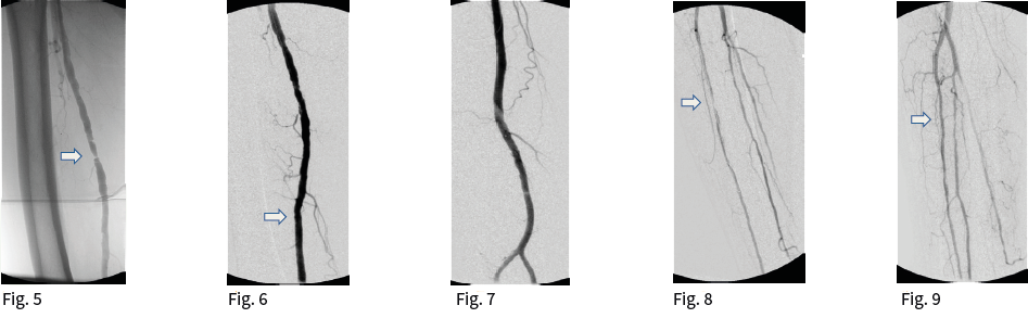 Case 3 Image 2.1.png