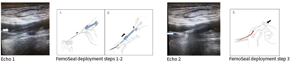Case report 3 Image 3.3.png